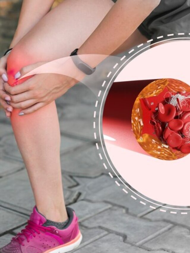 Lack of blood in the bodyThese are 5 symptoms of iron deficiency
